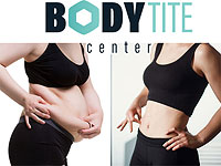 Body Tite: избавление от лишнего жира c одновременной подтяжкой кожи Body Tite: избавление от лишнего жира c одновременной подтяжкой кожи
