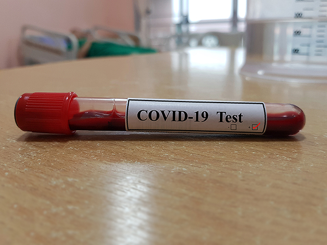 В КНР обнародован первый отчет по вирусу Covid-19: уровень смертности &#8211; 2,3%