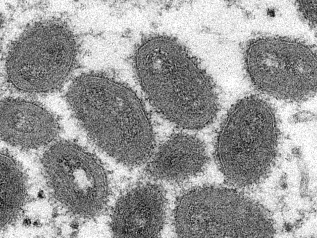 WHO convenes experts to discuss monkeypox outbreak