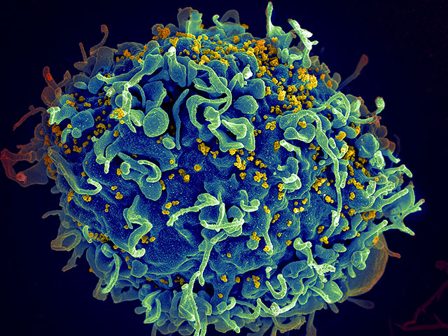 Israel has more HIV carriers than expected