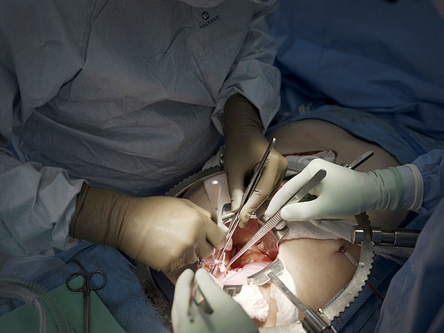 A woman receives the first combined pig kidney and thymus gland transplant in medical history