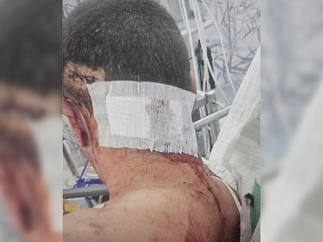 Спор о войне в Украине завершился поножовщиной на стройплощадке в Холоне