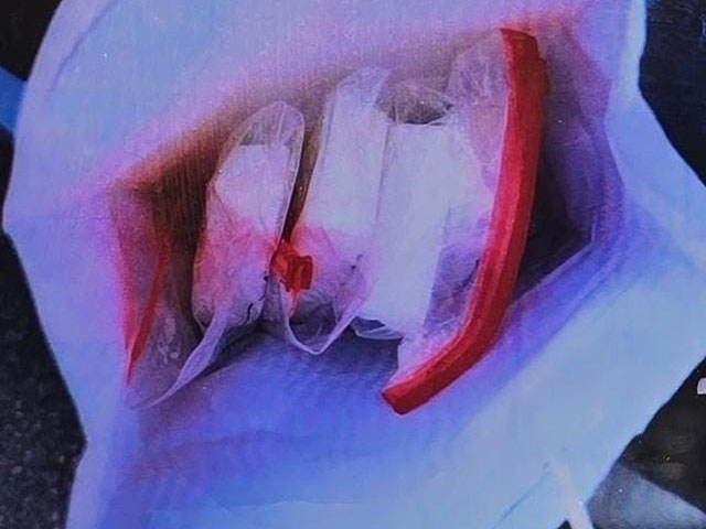 Бывший "Мистер Израиль" и его жена-воспитательница подозреваются в наркоторговле