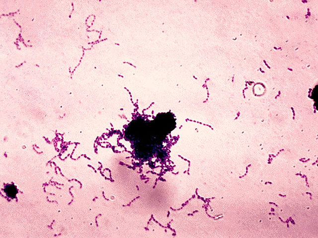 Streptococcus mutans под микроскопом