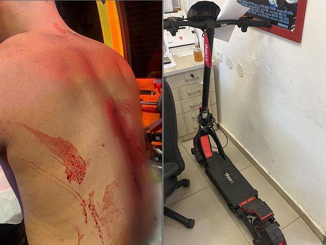 В Холоне ограблен и ранен курьер службы доставки, задержаны подозреваемые
