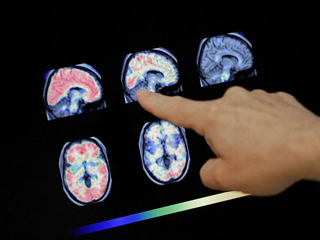 У взрослых людей новые клетки мозга продолжают формироваться и после 70 лет