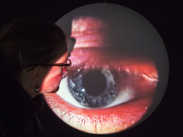 Сканирование глаза может выявить риски для сердца