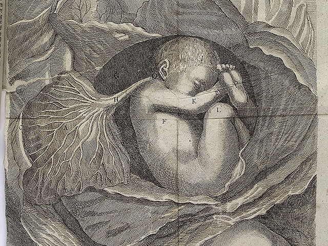 Голландский стартап разрабатывает искусственную матку для спасения недоношенных детей