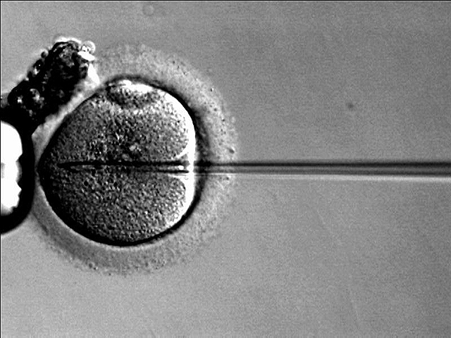 In Europe, 200 children were conceived from a sperm donor with a gene mutation leading to cancer.