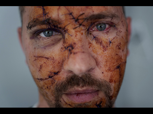 Константин Бычек после ранения на фронте. Киев, Украина, 25 апреля 2025 года