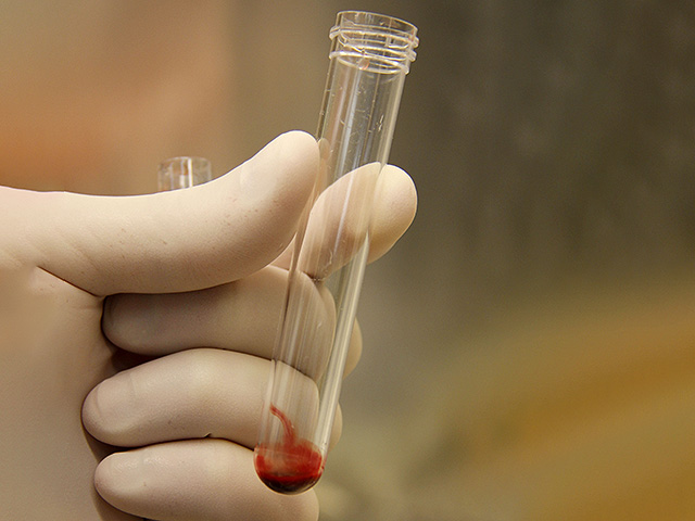 "Адаса Эйн-Керем" и "Шаарей Цедек" сообщили, что в крови детей не обнаружено следов отравления