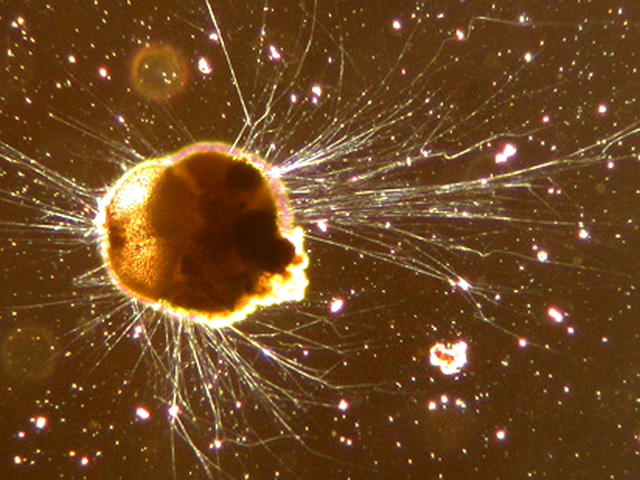 Фораминифера