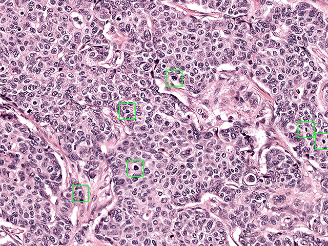 Раковая клетка сама ломает свою ДНК, и это можно использовать против нее