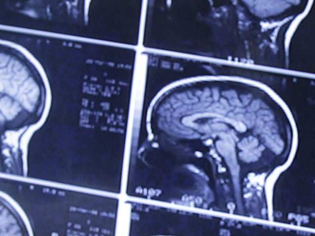 Израильские ученые выявили область мозга, которая отличается у мужчин и женщин и влияет на поведение