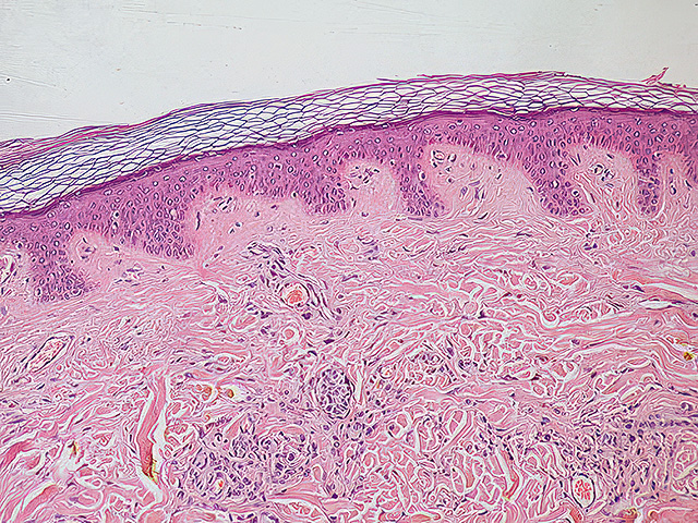 Израильские ученые нашли ген в клетках кожи, который помогает ее иммунной защите