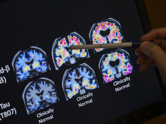 Ученые использовали стимуляцию мозга, чтобы сделать людей более щедрыми