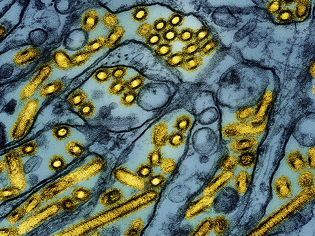 Ученые впервые в прямом эфире наблюдали за тем, как вирус гриппа заражает клетки человека