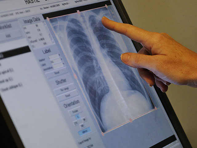 Воздействие микробов может приучить легкие к сопротивлению астме