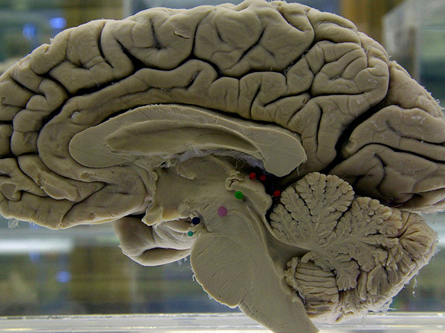 Возможно, вся система удовольствия в мозге всего лишь следствие настройки энергического баланса