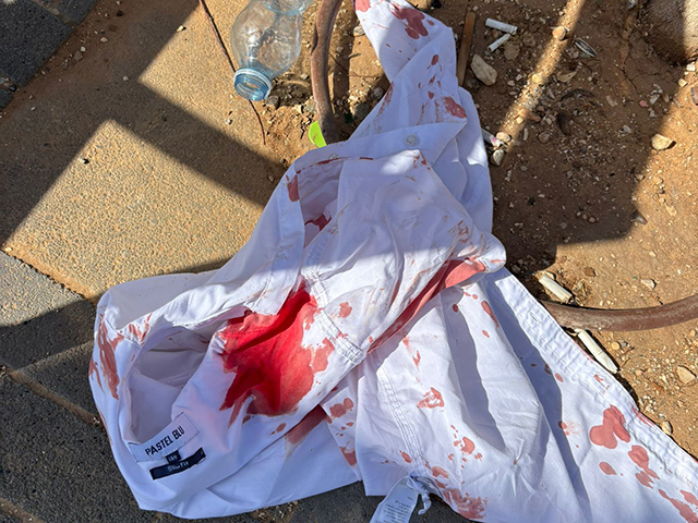 В Лоде 12-летний подросток задержан по подозрению в нападении на сверстника