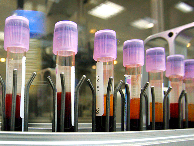 В Израиле разработана методика "сверхранней" диагностики рака по анализу крови