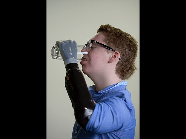 13-летний подросток, лишившийся руки, получил один из первых в мире сенсорных протезов