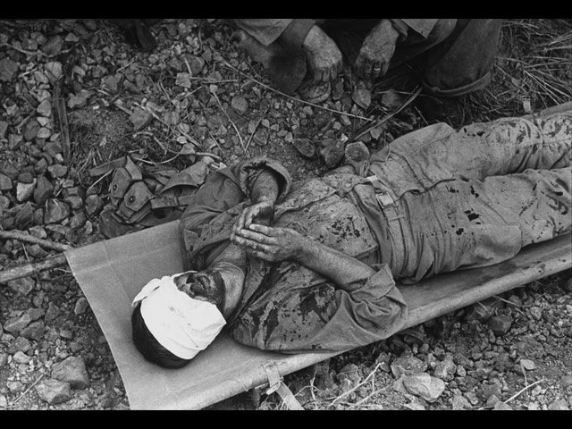 Американский солдат, раненный в сражениях за остров Окинава. Апрель 1945