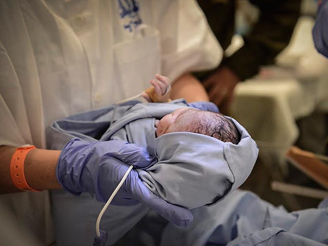 Минздрав: объем головы новорожденных в районе Хайфы не отличается от среднего по стране 