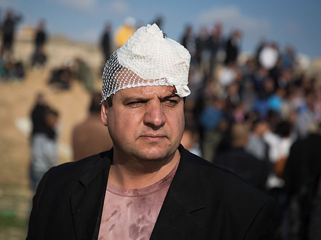 Депутат Кнессета Айман Удэ, получивший легкое ранение в голову во время столкновений между полицейскими и участниками акции протеста против сноса незаконных построек в Умм аль-Хиране