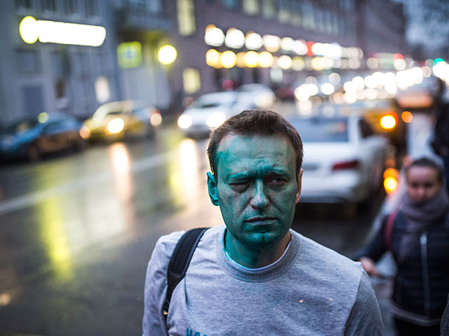 Облитый зеленкой Навальный после нападения на него 27 апреля 2017 года