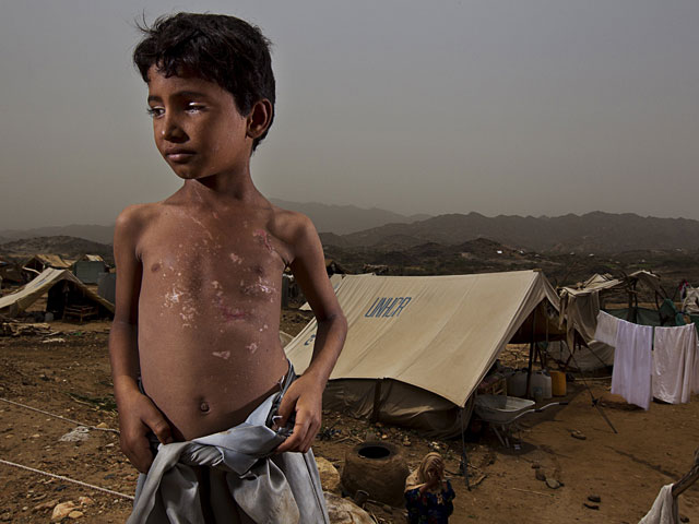 ООН: более восьми миллионов йеменцев на грани голода    