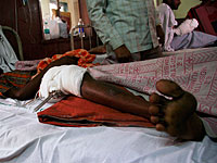 Шокирующее видео: подушкой для пациента больницы в Индии служит отрезанная нога