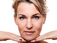 Fractora: омоложение лица на длительный срок методом полного обновления кожи