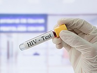 Россия стала лидером среди стран Европы по темпам распространения ВИЧ