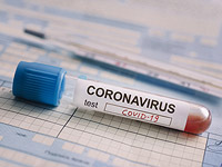 Ученые установили, при какой температуре гибнет новый коронавирус