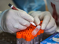 МАДА открыла 17 пунктов проведения тестов PCR для выезжающих за границу