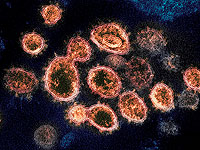 В Европе зафиксирован первый случай заражения южноафриканским штаммом коронавируса