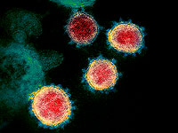 В минздраве обсудят данные о новом штамме коронавируса, обнаруженном во Франции