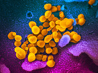 Отчет комиссии Lancet: не исключено лабораторное происхождение коронавируса