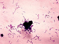 Streptococcus mutans под микроскопом