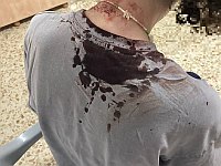 Правозащитницы пострадали при нападении ультраправых активистов на бедуинский Мухмас Правозащитницы пострадали при нападении ультраправых активистов на бедуинский Мухмас