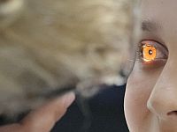 Новое лазерное лечение может остановить слепоту еще до ее наступления