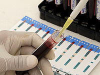 Химики разработали метод анализа крови для раннего выявления деменции Химики разработали метод анализа крови для раннего выявления деменции