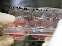 Ученые создали искусственный хрящ с использованием стволовых клеток костного мозга