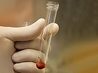 "Адаса Эйн-Керем" и "Шаарей Цедек" сообщили, что в крови детей не обнаружено следов отравления