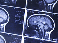 Ученые представили крошечный мозговой чип, который передает мысли в режиме реального времени