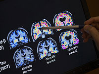 Сон запускает в мозге "режим очищения"