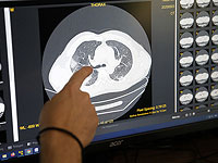 Ученые выявили "нейронный отпечаток" психоделических препаратов в мозге