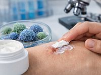 Создан крем, который "пробуждает" иммунную систему для борьбы с раком кожи
