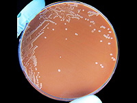 Бактерия Haemophilus influenzae